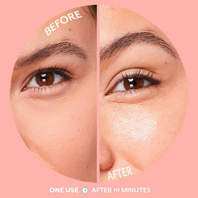 Bubbly Brightening Under Eye Gel Pack | 5 Pairs | Patchology | boogie + birdie