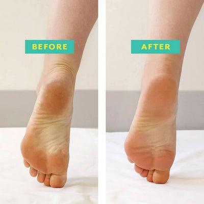 PoshPeel Foot Exfoliating Booties | Patchology | boogie + birdie